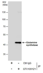 Anti-Glutamine synthetase antibody used in Immunoprecipitation (IP). GTX109121