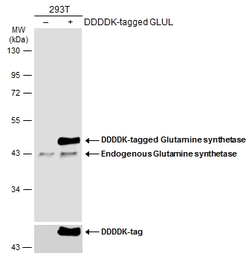 Anti-Glutamine synthetase antibody used in Western Blot (WB). GTX109121