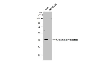 Anti-Glutamine synthetase antibody used in Western Blot (WB). GTX109121