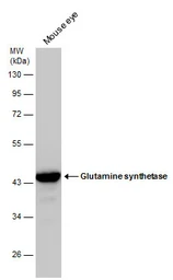 Anti-Glutamine synthetase antibody used in Western Blot (WB). GTX109121