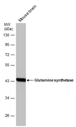 Anti-Glutamine synthetase antibody used in Western Blot (WB). GTX109121