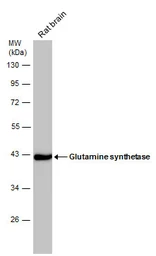 Anti-Glutamine synthetase antibody used in Western Blot (WB). GTX109121