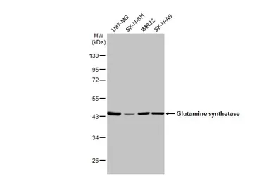 Anti-Glutamine synthetase antibody used in Western Blot (WB). GTX109121