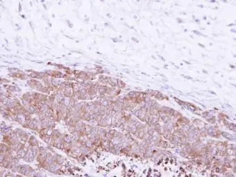 Anti-Glutamyl hydrolase gamma antibody [N1C3] used in IHC (Paraffin sections) (IHC-P). GTX109123