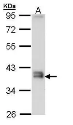 Anti-Glutamyl hydrolase gamma antibody [N1C3] used in Western Blot (WB). GTX109123