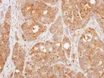 Anti-DUSP3 antibody [N1C3] used in IHC (Paraffin sections) (IHC-P). GTX109149