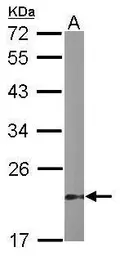 Anti-DUSP3 antibody [N1C3] used in Western Blot (WB). GTX109149