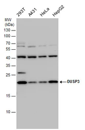 Anti-DUSP3 antibody [N1C3] used in Western Blot (WB). GTX109149