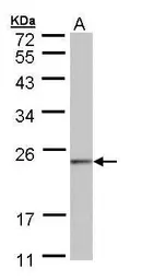 Anti-HRPAP20 antibody [N1C3] used in Western Blot (WB). GTX109156