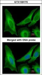 Anti-SAR1B antibody used in Immunocytochemistry/ Immunofluorescence (ICC/IF). GTX109170