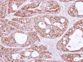 Anti-SAR1B antibody used in IHC (Paraffin sections) (IHC-P). GTX109170