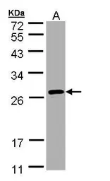 Anti-SAR1B antibody used in Western Blot (WB). GTX109170