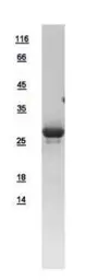 Human ETFB protein, His tag. GTX109189-pro