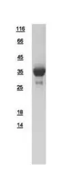 Human CRALBP protein, His tag. GTX109228-pro