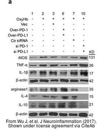 Anti-Arginase 1 antibody used in Western Blot (WB). GTX109242