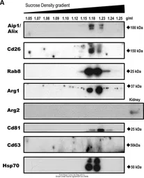 Anti-Arginase 1 antibody used in Western Blot (WB). GTX109242