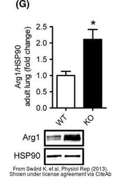 Anti-Arginase 1 antibody used in Western Blot (WB). GTX109242