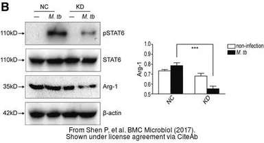 Anti-Arginase 1 antibody used in Western Blot (WB). GTX109242