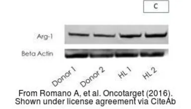 Anti-Arginase 1 antibody used in Western Blot (WB). GTX109242