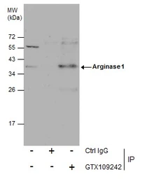 Anti-Arginase 1 antibody used in Immunoprecipitation (IP). GTX109242