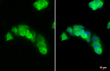 Anti-Arginase 1 antibody used in Immunocytochemistry/ Immunofluorescence (ICC/IF). GTX109242