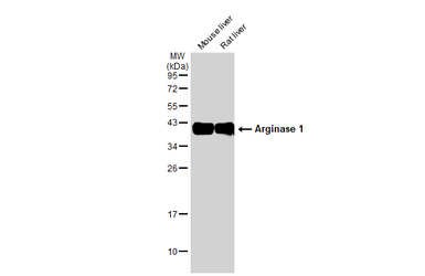 Anti-Arginase 1 antibody used in Western Blot (WB). GTX109242