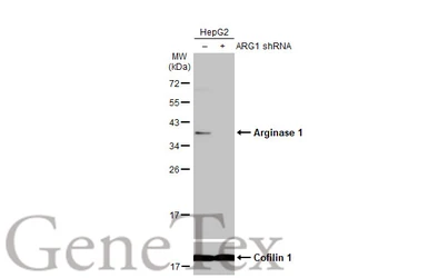 Anti-Arginase 1 antibody used in Western Blot (WB). GTX109242