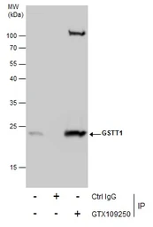 Anti-GSTT1 antibody used in Immunoprecipitation (IP). GTX109250