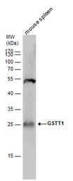 Anti-GSTT1 antibody used in Western Blot (WB). GTX109250