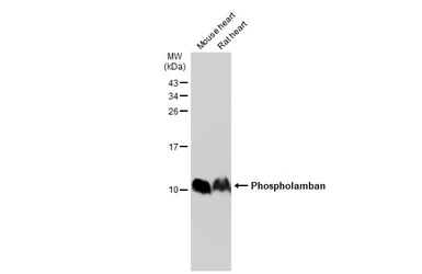 Anti-Phospholamban antibody used in Western Blot (WB). GTX109254