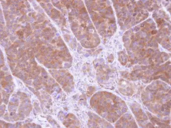 Anti-Tropomyosin 2 antibody [N1C3] used in IHC (Paraffin sections) (IHC-P). GTX109268