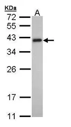 Anti-Tropomyosin 2 antibody [N1C3] used in Western Blot (WB). GTX109268