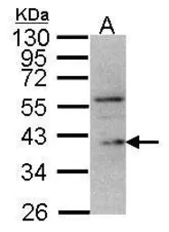 Anti-DUSP12 antibody [N1N3] used in Western Blot (WB). GTX109287