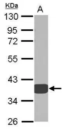 Anti-AKR1D1 antibody used in Western Blot (WB). GTX109328