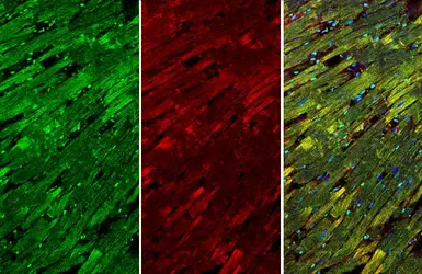 Anti-Cardiac Troponin I antibody [N1C3] used in IHC (Paraffin sections) (IHC-P). GTX109331