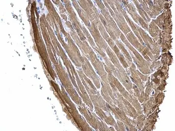 Anti-Cardiac Troponin I antibody [N1C3] used in IHC (Paraffin sections) (IHC-P). GTX109331