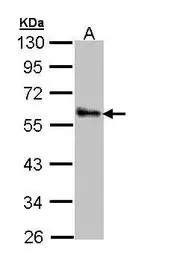 Anti-ZNF259 antibody [N3C3] used in Western Blot (WB). GTX109364