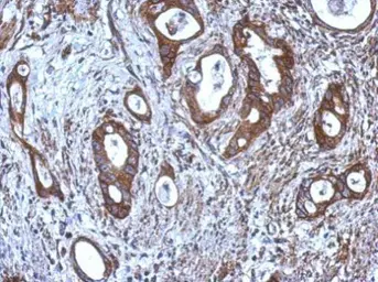 Anti-CNDP1 antibody used in IHC (Paraffin sections) (IHC-P). GTX109366