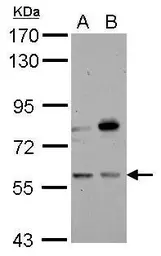 Anti-CNDP1 antibody used in Western Blot (WB). GTX109366