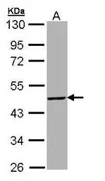 Anti-TBX19 antibody [N1C1] used in Western Blot (WB). GTX109384