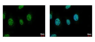 Anti-CDC45L antibody [C1C3] used in Immunocytochemistry/ Immunofluorescence (ICC/IF). GTX109454