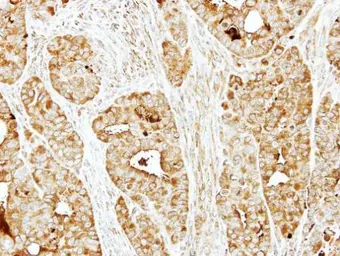 Anti-BBS10 antibody [N2C1], Internal used in IHC (Paraffin sections) (IHC-P). GTX109475