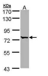 Anti-BBS10 antibody [N2C1], Internal used in Western Blot (WB). GTX109475