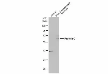 Anti-Protein C antibody [N2C3] used in Western Blot (WB). GTX109504