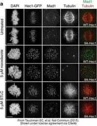 Anti-MAD1 antibody used in Immunocytochemistry/ Immunofluorescence (ICC/IF). GTX109519