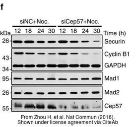 Anti-MAD1 antibody used in Western Blot (WB). GTX109519