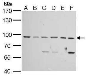 Anti-MAD1 antibody used in Western Blot (WB). GTX109519