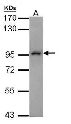 Anti-MAD1 antibody used in Western Blot (WB). GTX109519