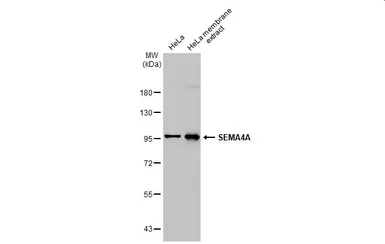 Anti-SEMA4A antibody [C1C3] used in Western Blot (WB). GTX109538