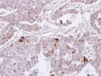 Anti-SEMA4A antibody [C1C3] used in IHC (Paraffin sections) (IHC-P). GTX109538